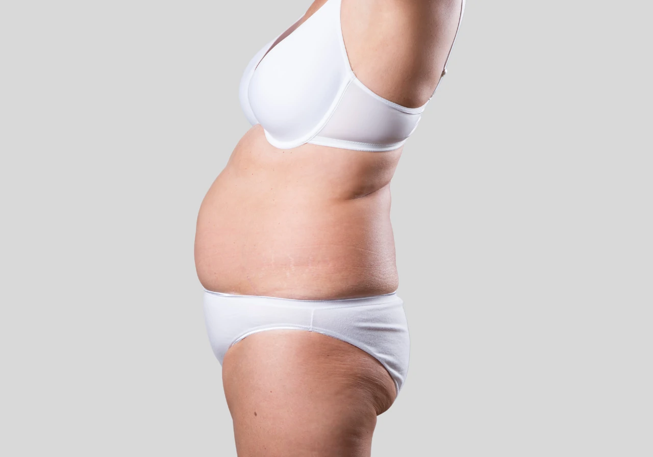 ARTES FIT-LIFE TRANSFORMATION (12)